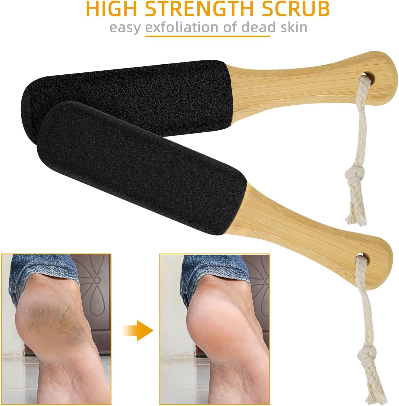 2 Pack Pumice Stone for Feet, Foot File and Callus Remover - Foot Scraper & Exfoliator Tool for Dead Skin, Cracked Heels, Dry Feet Care