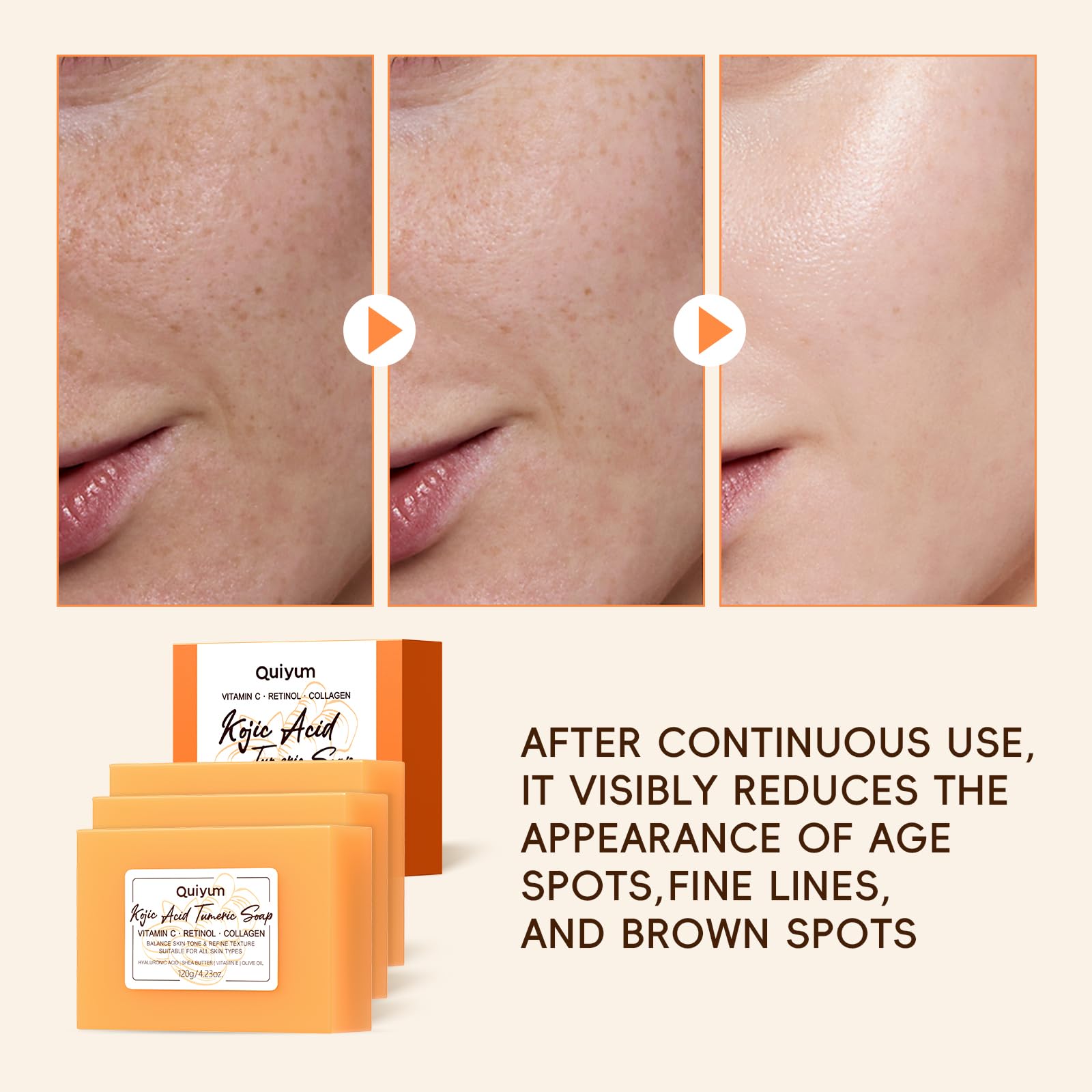 Quiyum Kojic Acid & Turmeric Soap Bar, 3x120g Dark Spot Corrector, Hyperpigmentation Treatment with Vitamin C - Image 2