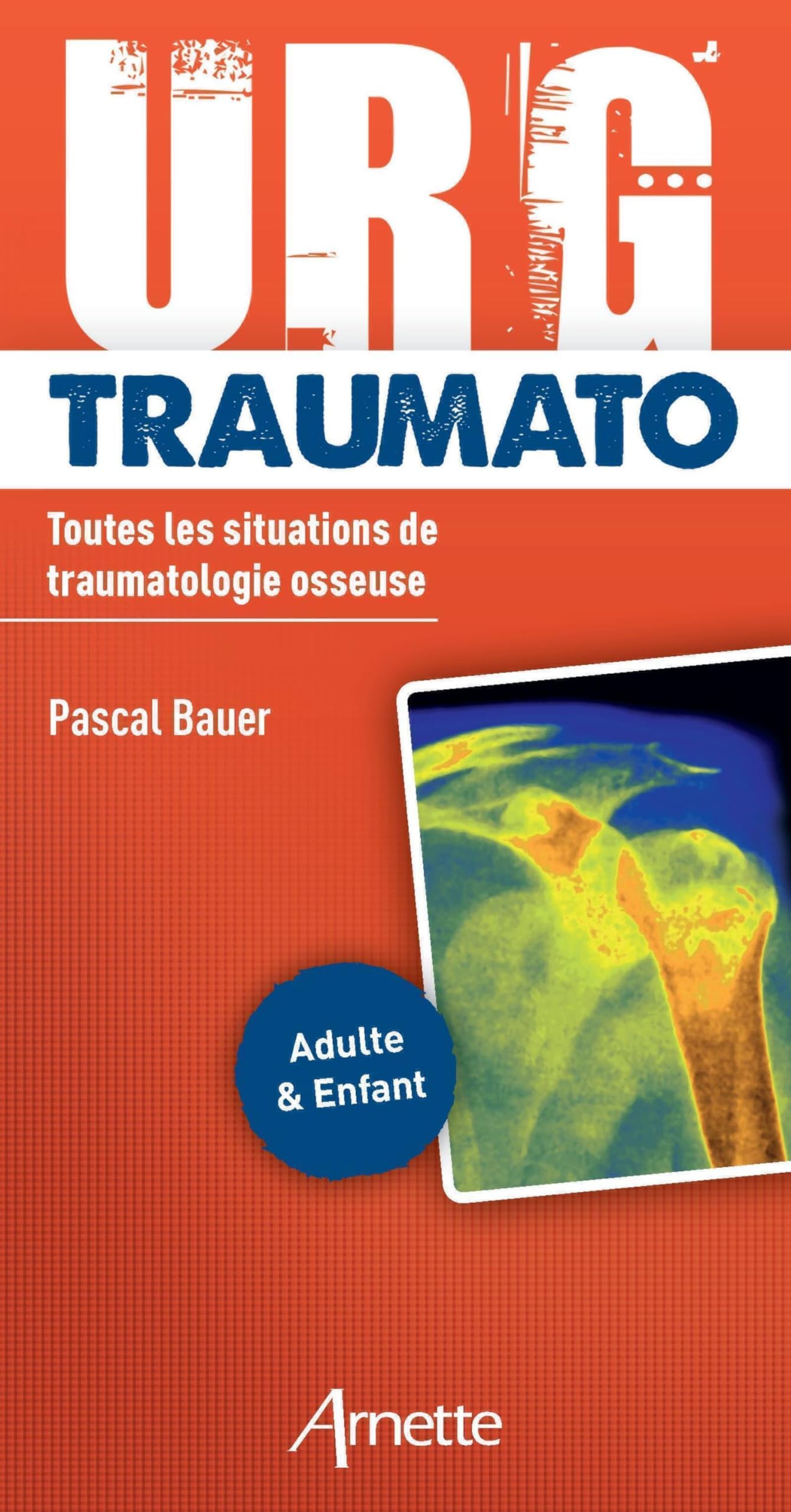 URG' Traumato: Toutes les situations de traumatologie osseuse. Adulte et enfant