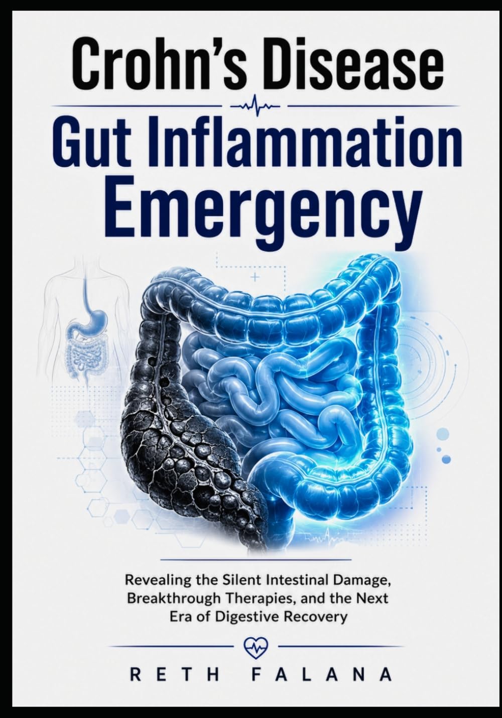 Crohn's Disease Gut Inflammation Emergency: Revealing the Silent Intestinal Damage, Breakthrough Therapies, and the Next Era of Digestive Recovery