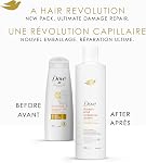 Dove Dryness & Shampooing de soulagement et revitalisant pour cuir chevelu sec et démangeaison, avec technologie de soins bioprotéines liquides, 355 ML (2 Shampooing + 2 Conditionneur)
