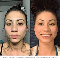 Vista 4 de Bioelements Flash Foam Cleanser - 6.5 onzas líquidas - Limpiador de espuma exfoliante para piel grasa, mixta y seca, vegano, sin gluten