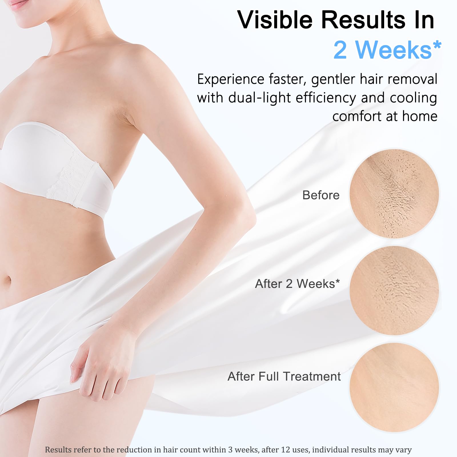 Depiladora Laser Mujer – 999.999 Destellos, 3 Niveles de Energía & Modos SHR/AUTO – Depiladora IPL con Luz Pulsada para Axilas, Piernas, Bikina y Rostro (Para Casa)