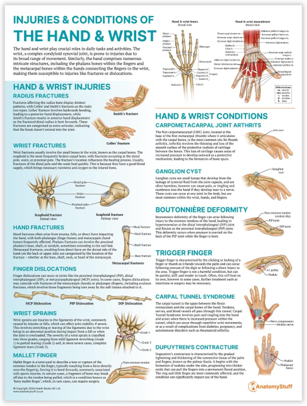 Anatomy Stuff Injuries and Conditions of the Hand and Wrist Poster ...