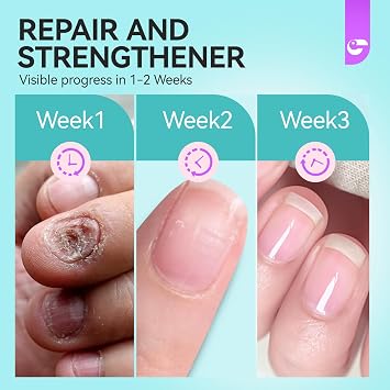 Stop Biting Nail Pen for Adults - Gelike EC Bitter Taste Treatment for Thumb Sucking Deterrent - Easy and Quickly Stop Nail-biting Habit with Safe Solution