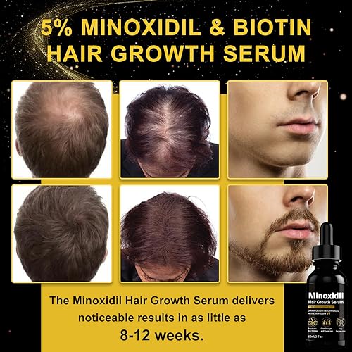 Miniatura 2 de Suero de crecimiento del cabello de minoxidil al 5%, minoxidil tópico para el crecimiento de la barba, crecimiento del cabello para mujeres,