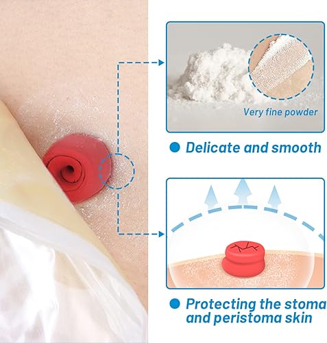 Miniatura 2 de Polvo de estoma heagied, suministros de polvo de ostomía de protección de barrera cutánea, polvo adhesivo para estoma, polvo para el cuidado de la