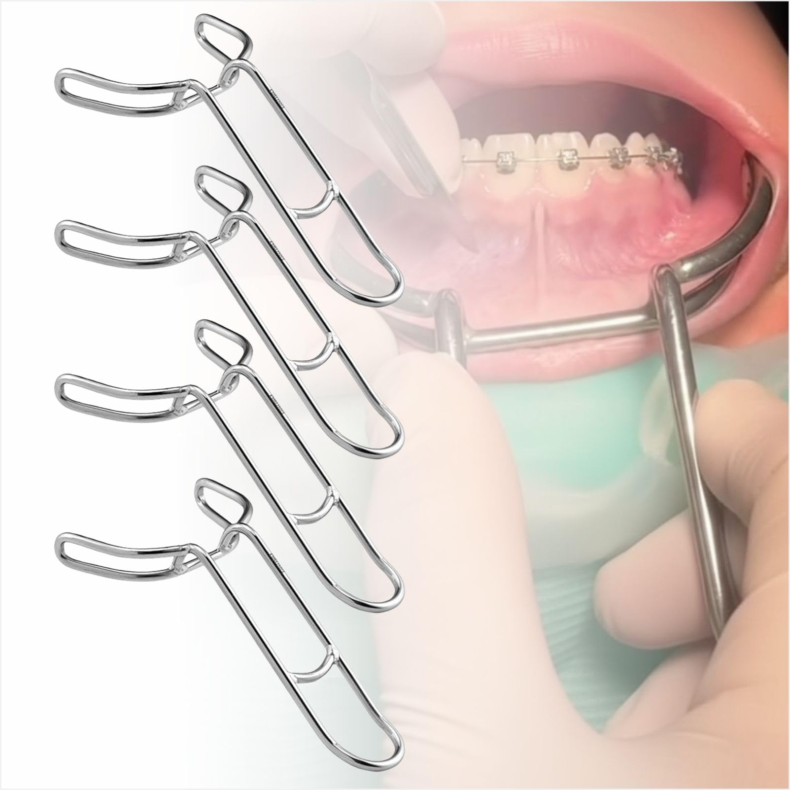 Divaricatore dentale per guance, ortodontico, per labbra e guance, strumento di apertura intraorale della bocca per clinica, sbiancamento dei denti, esame orale e fotografia, confezione da 4