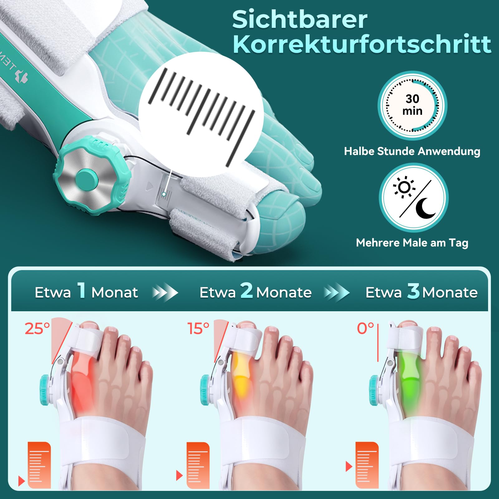 Hallux Valgus Korrektur Einstellbarer Knopf Hallux Valgus Schiene Ballenzeh Mann Frau Zehen Begradigen Links Rechts Fuß Aktualisierte Fassung 2 Stück
