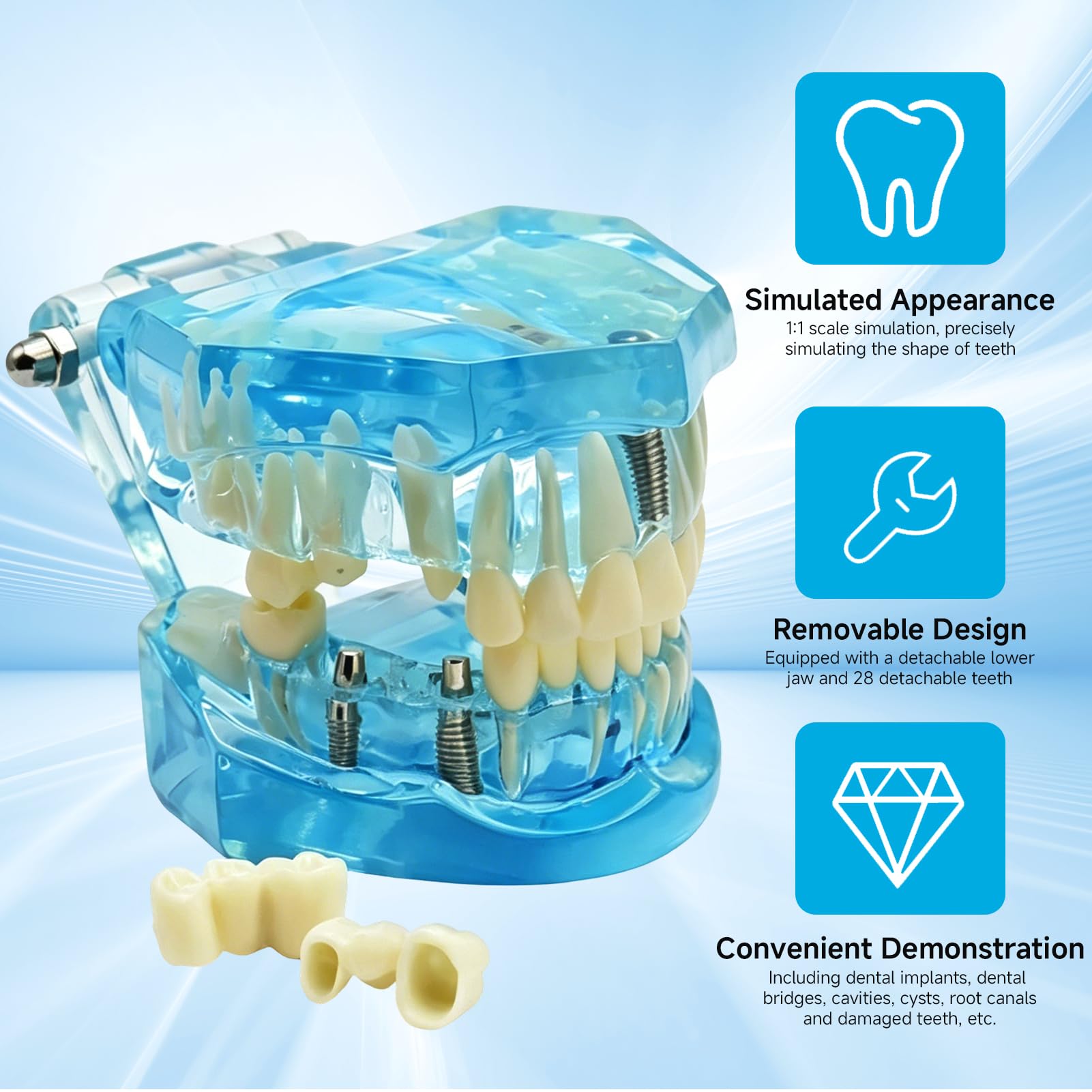 Zahnmodell mit Herausnehmbaren ZäHnen, Zahnimplantat Zahnmodell,Transparentes Modell Erkrankter ZäHne, modell für Zahnarzt, Dental Model für Demonstrationen und Studien(Blau)