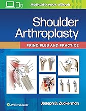 Shoulder Arthroplasty: Principles and Practice