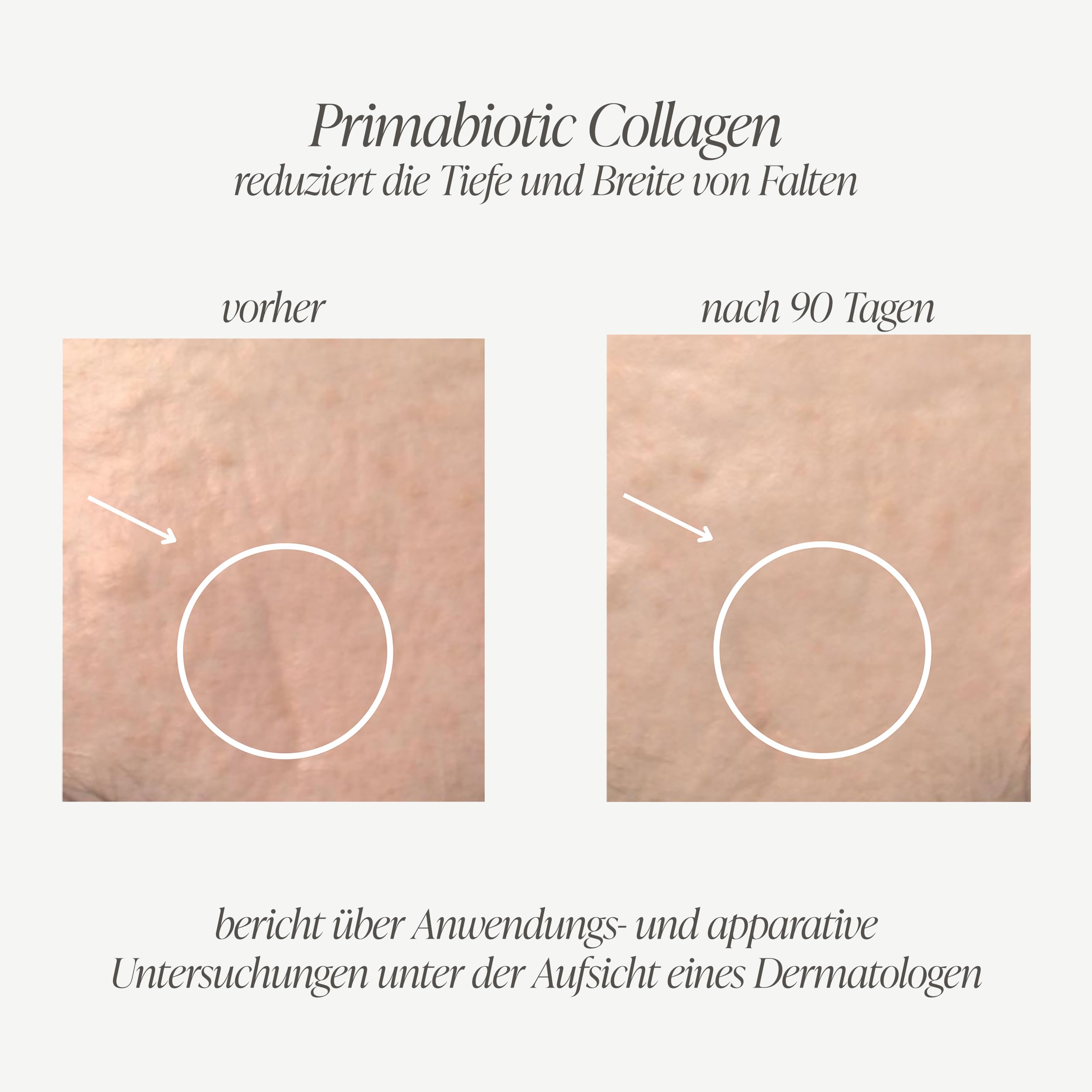Kollagen Trinkampullen – Primabiotic Collagen Peptide 10000 mg | 60 Ampullen à 30 ml (1800 ml) | Flüssiger Beauty Drink in Premium-Qualität | 95% Absorption | Für Haut, Haare & Gelenke