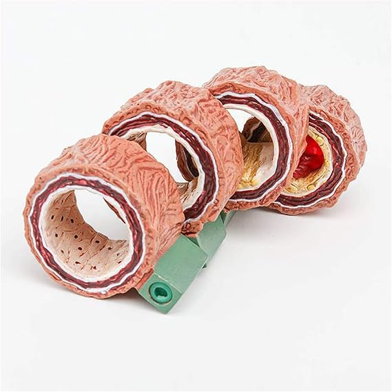 4-Piece Artery Model with Detachable Base, Realistic Human Artery Blood Vessel Anatomy Model, Arteriosclerosis Teaching Tool for Anatomy and Physiology Education