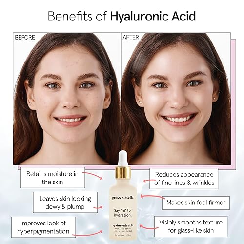 Vista 3 de grace & stella Award Winning Hyaluronic Acid Serum (10ml/0.34 fl oz) Hyaluronic Acid Serum for Face - Acido Hialuronico Face Serums for Women