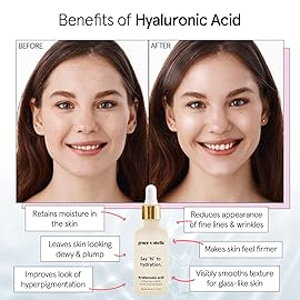 grace & stella Award Winning Hyaluronic Acid Serum (10ml/0.34 fl oz) Hyaluronic Acid Serum for Face - Acido Hialuronico Face Serums for Women - Hydrating, Remove Fine Lines, Wrinkles - Anti Aging