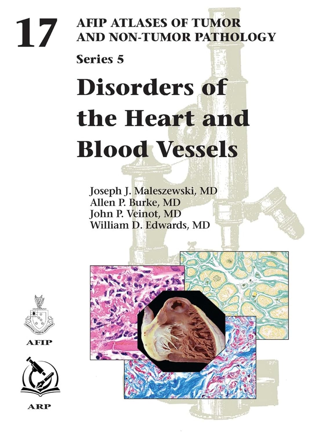 Disorders of the Heart and Blood Vessels: 17 (AFIP Atlas of Tumor and ...