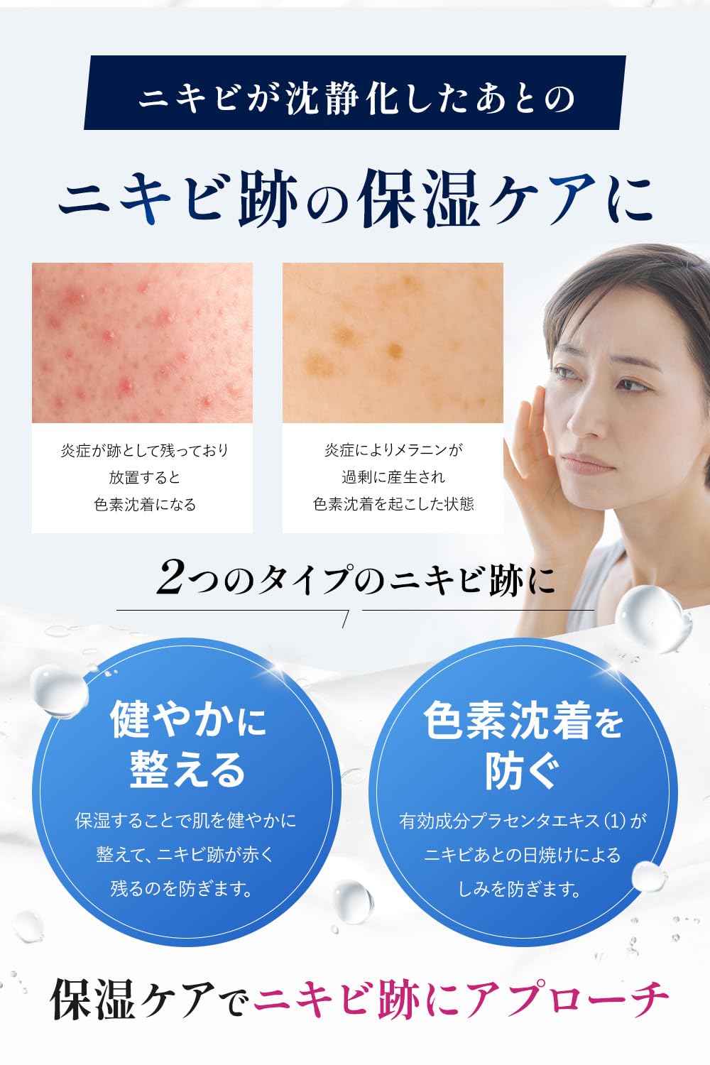 Amazon.co.jp: アラジル クリアピーリングゲル 80g 医薬部外品 ニキビ