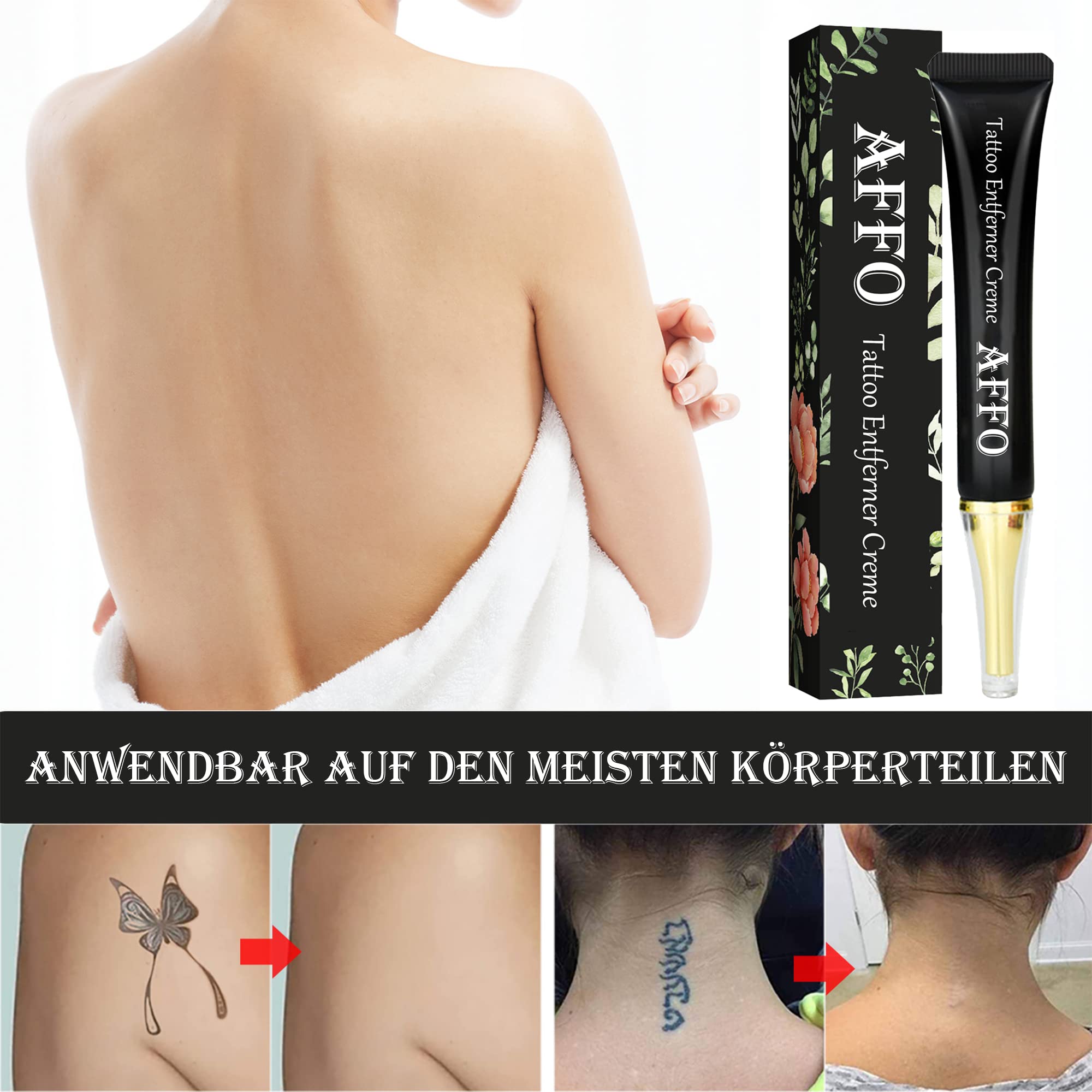 2022 Tattoo Remover Cream, AFFO Tattoo Removal Cream, Anti-Tattoo Print  Cream, Safe Moisturising Skin Scar Repair Cream for Coloured and Black Tattoos  Removal (Pack of 2) : Amazon.de: Beauty