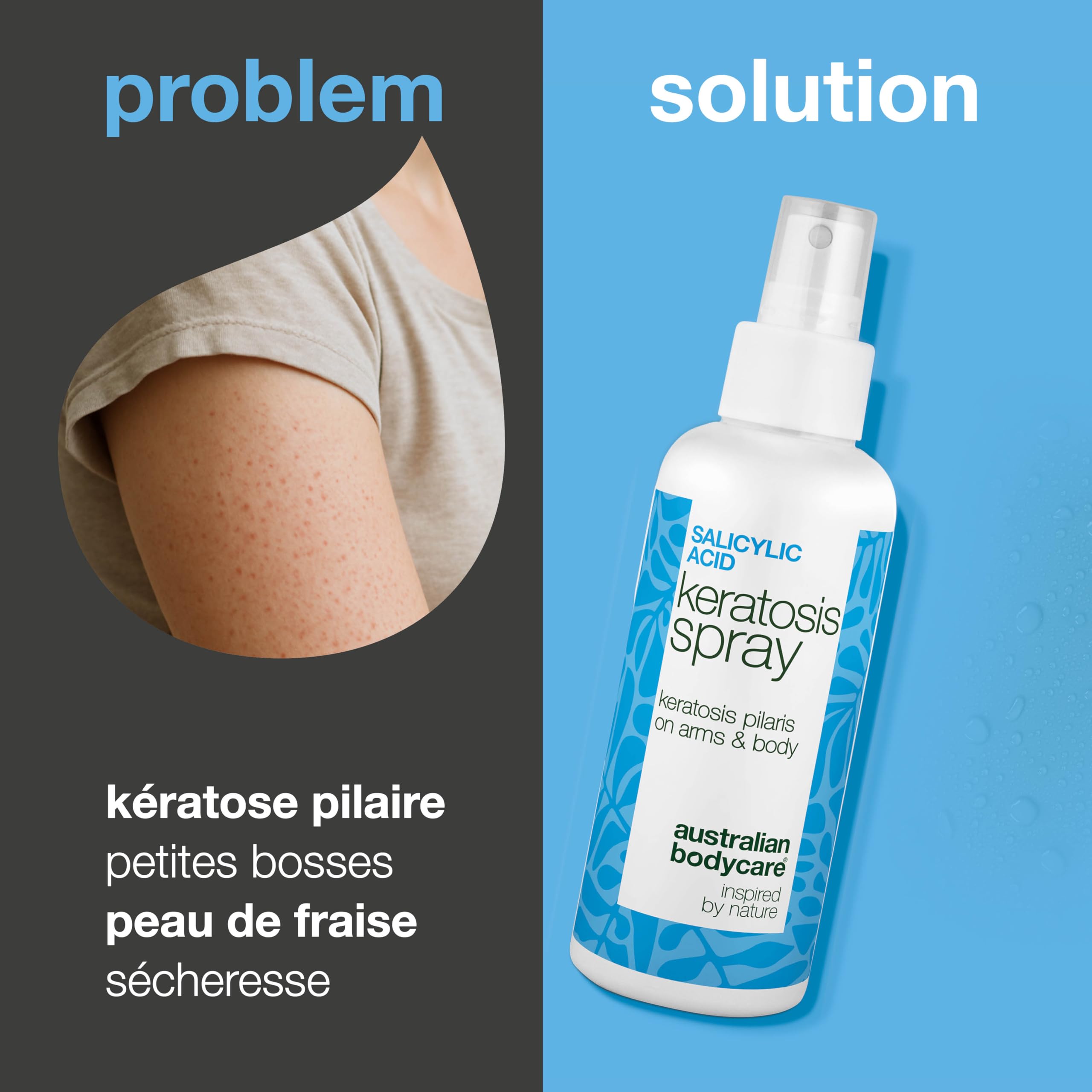 Spray kératose pilaire pour peau rugueuse, chair de poule et peau de fraise – avec acide salicylique, acide glycolique, glycérine et panthénol