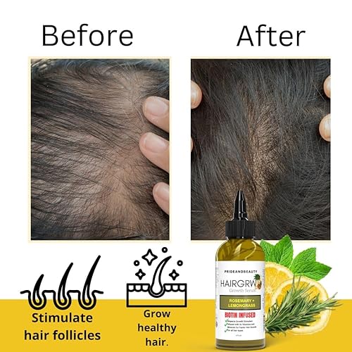 Miniatura 5 de Aceite de romero para el crecimiento del cabello, infundido con biotina para un crecimiento más rápido del cabello, suero de crecimiento extremo del