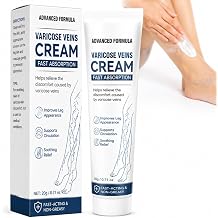 Vigorder Varicose Veins Treatment for Legs, Varicose Veins Cream for Spider Veins, Helps Improve Circulation, Relieves Tired Heavy Feeling, Moisturizing Support for Daily Leg Care