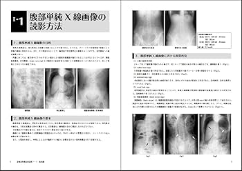 臨床解剖学ノート　腹部編　(I)　(II) Amazon.co.jp: 臨床解剖学ノート 腹部編 2 : L.Perlemuter, J