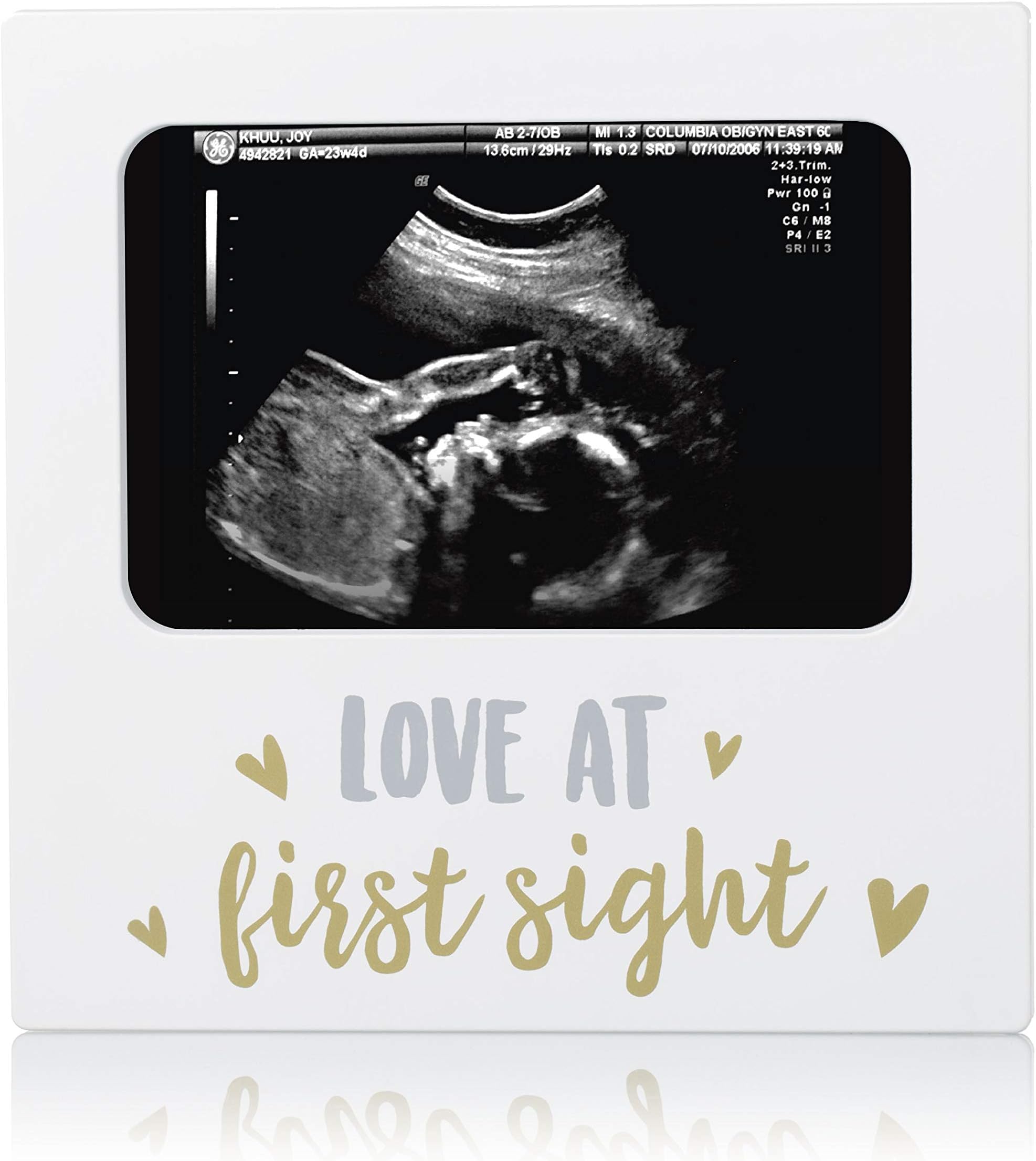 Little pear Sonogram Keepsake Frame, Thoughtful Gifts For New Parents, Newborn Registry Must Haves, Silver