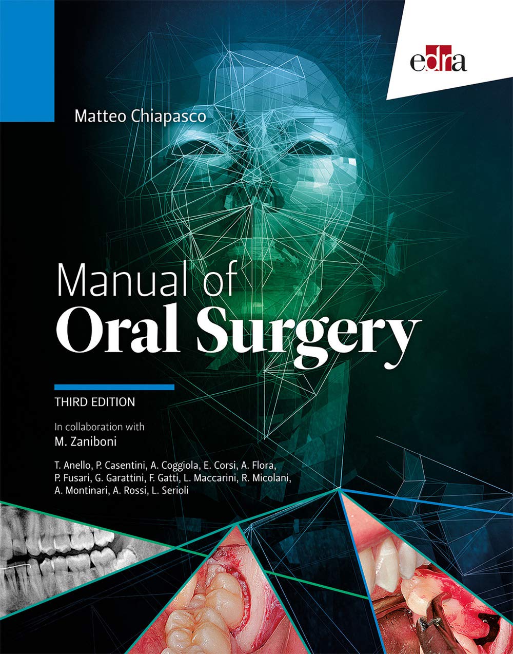 Manual of Oral Surgery (3rd Edition) - Medicine books - Edizioni Edra (MANUALES)