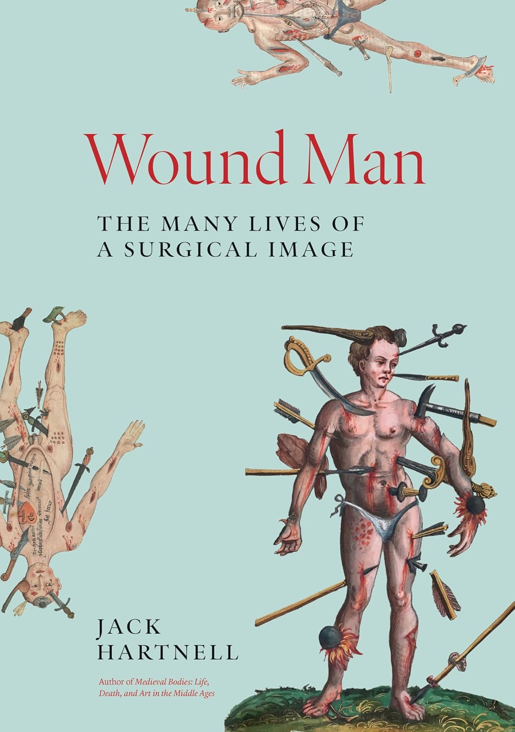 Wound Man: The Many Lives of a Surgical Image      Hardcover – August 19, 2025
