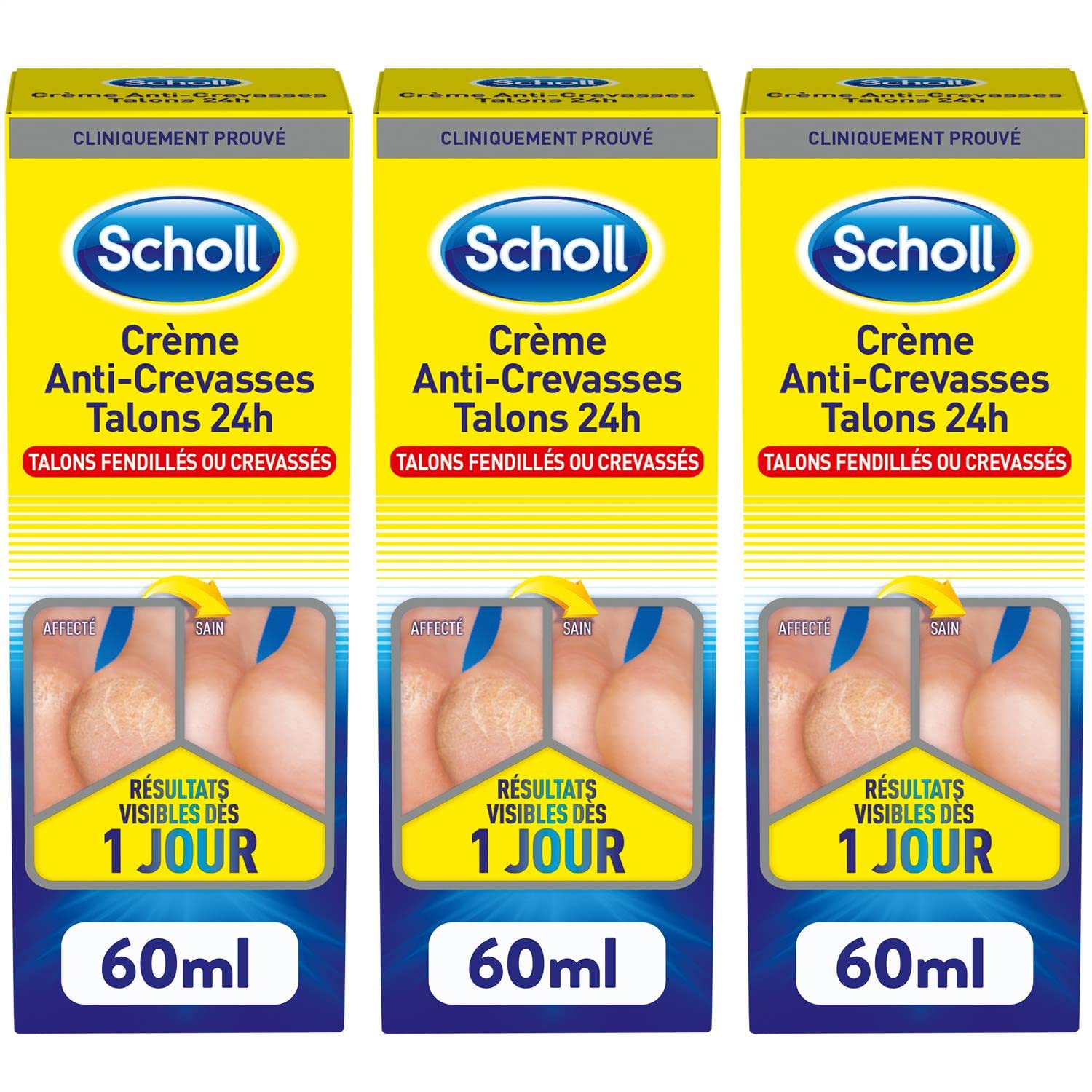 SCHOLL - Juego de 3 cremas antirevasas, 24 horas