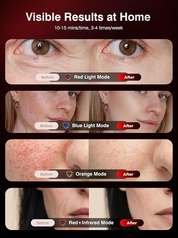 4D Wireless Red Light Therapy Mask for Face with 328 LEDs Face Mask image 6