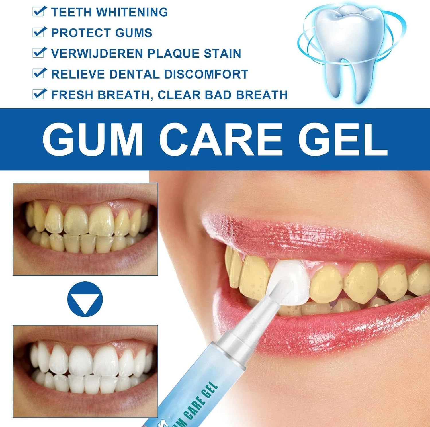 Taileden Gum Therapy Gel Taileden Gum Therapy Gel pour gencives encastrées, gel de thérapie des gencives Aulrz Taileden, gel de thérapie des gencives Aulrz, gel thérapeutique TailedenGum, gel de soin