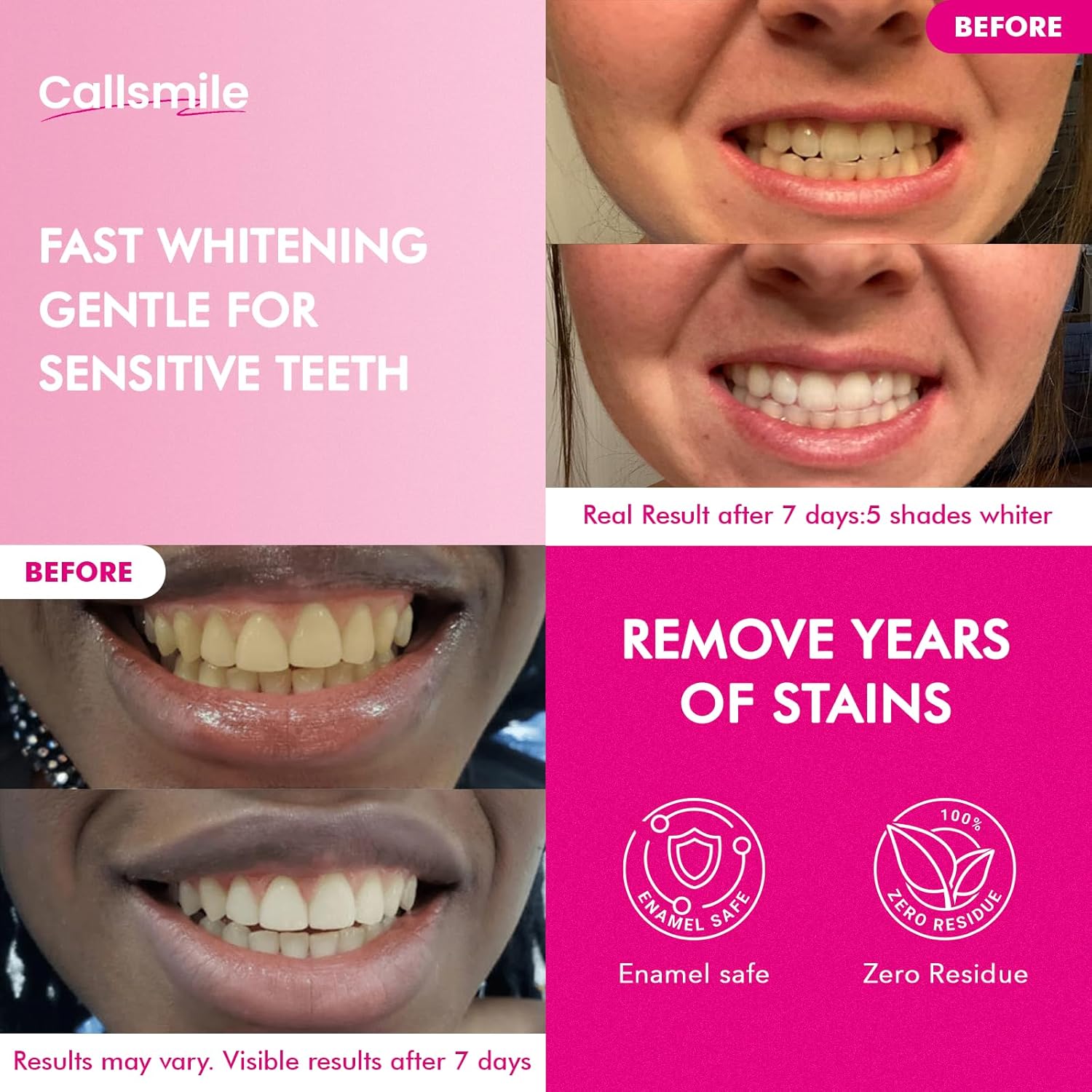 CALLSMILE Whitening Strips for Teeth Sensitive: 64 Strips Gentle Teeth Whitening Strips Enamel Safe Non-Slip Dry Strip Technology Residue Free Daily Oral Care, Coconut