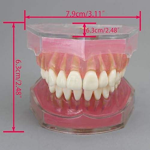 Miniatura 7 de Modelo de dientes de implante dental con dientes extraíbles para profesionales dentales y estudiantes