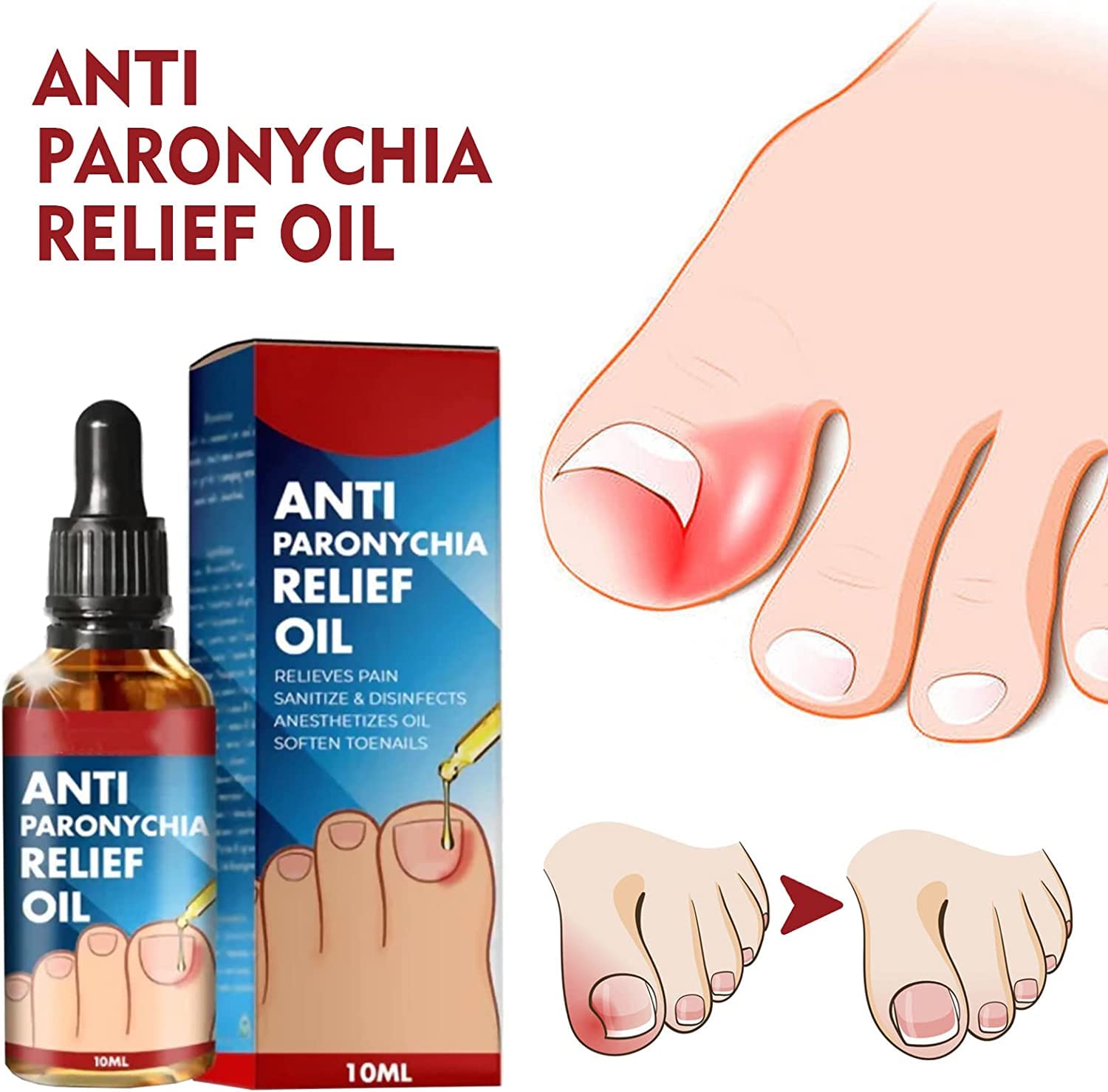 German Toenailplus Anti Paronychia Relief Oil,10ML Anti Paronychia Relief Oil, Ingrown Toenail Drops, Nail Helper Ingrowth Toenail Correction Treatment Oil Zehennagel Tropfen (4PC)