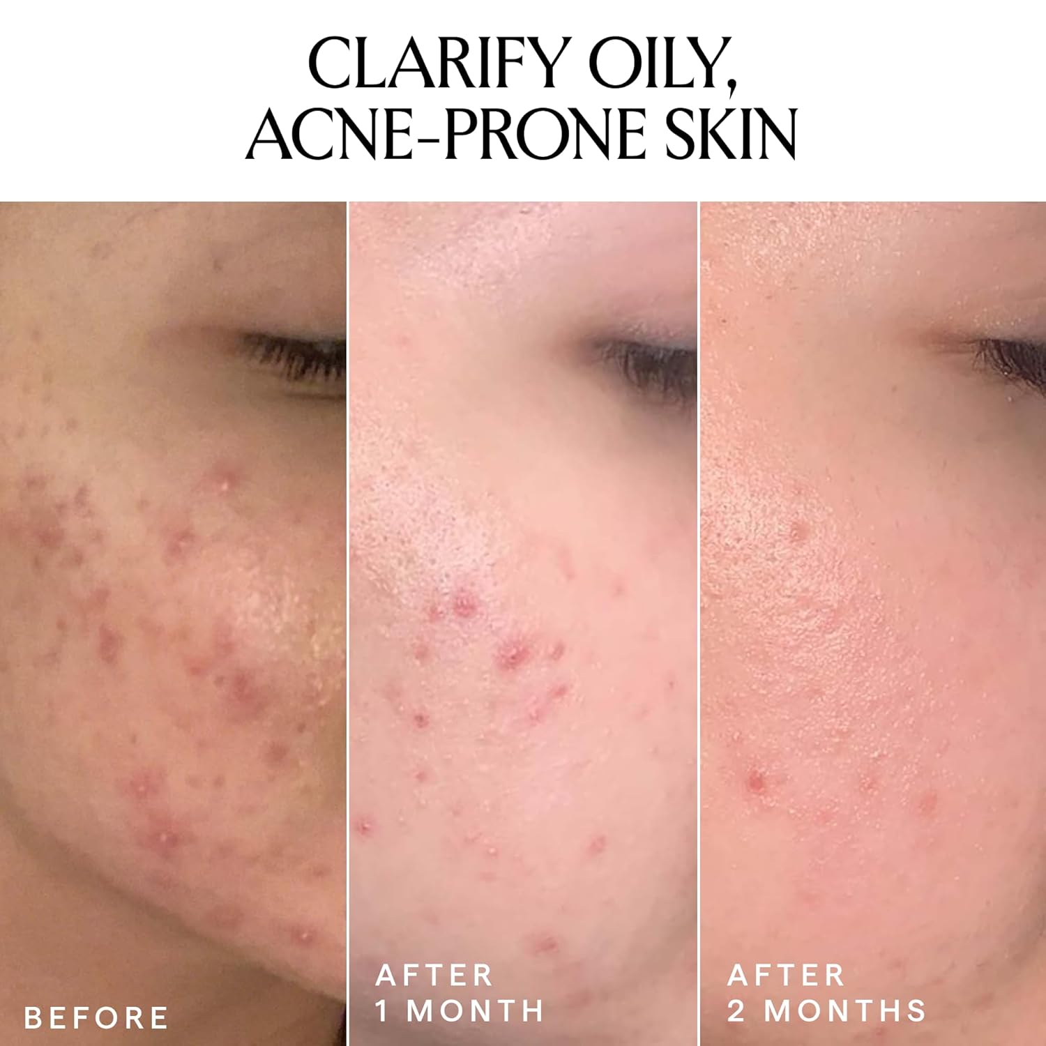 HERBIVORE Lapis Facial Oil | Balances Oil & Soothes Redness with Blue Tansy & Squalane | Safe for Oily & Acne Prone Skin, Non-Comedogenic, Vegan - Image 5