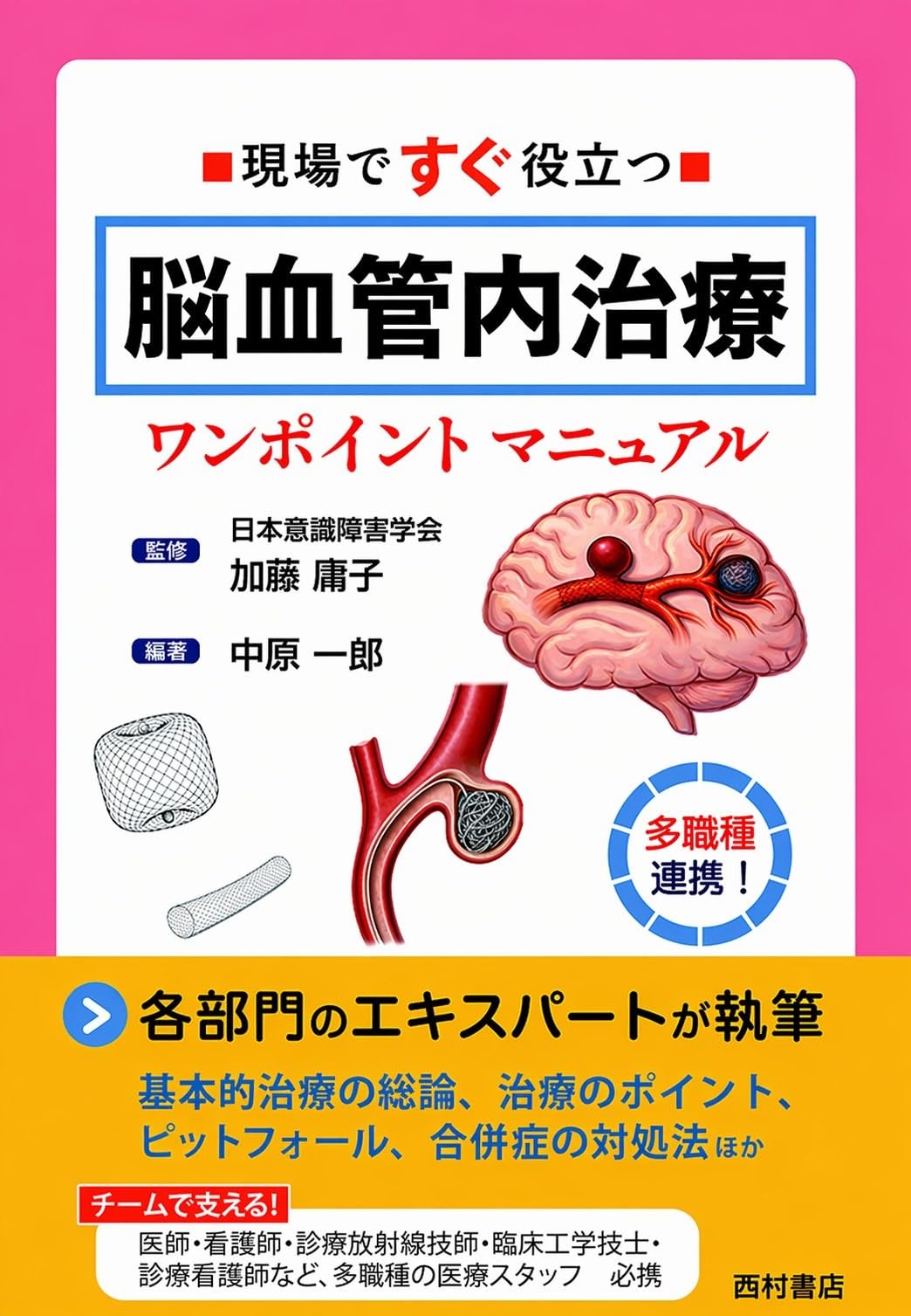 Amazon.co.jp: 現場ですぐ役立つ 脳血管内治療ワンポイントマニュアル