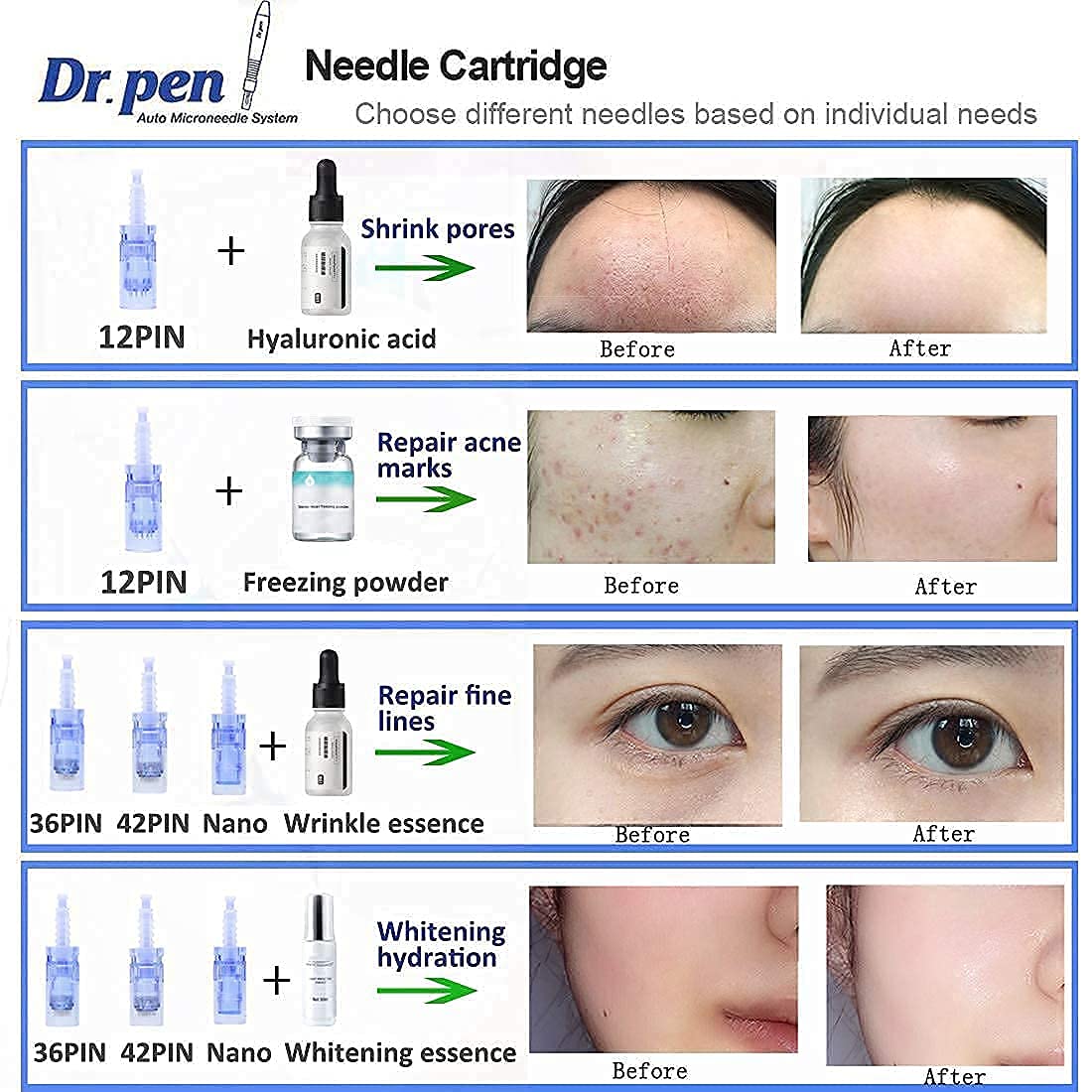 Dr.pen Ultima A6 Dermapen Microneedle eléctrico Auto Stamp Cartuchos Arrugas Estrías Cicatriz de acne Perdida de cabello Recargable Derma Pen 0.25-2.5mm para Facial y Cuerpo