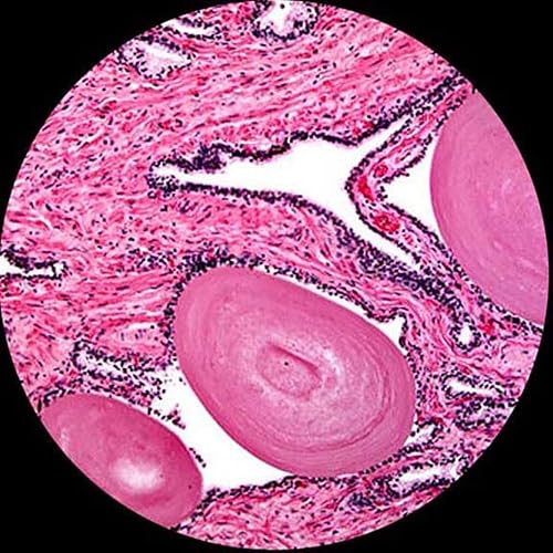 Miniatura 4 de AmScope Microscopio monocular compuesto de doble vista D120C-MS, objetivos WF10x y WF25x, aumento 40X-2500X, Brightfield, condensador Abbe de 1,25
