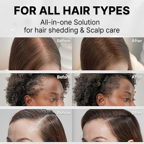 Miniatura 6 de lilyeve GROWTURN Suero de Crecimiento Capilar con Cepillo Integrado, Exosomas Derivados de Heartleaf para Revitalizar el Cabello, Engrosamiento