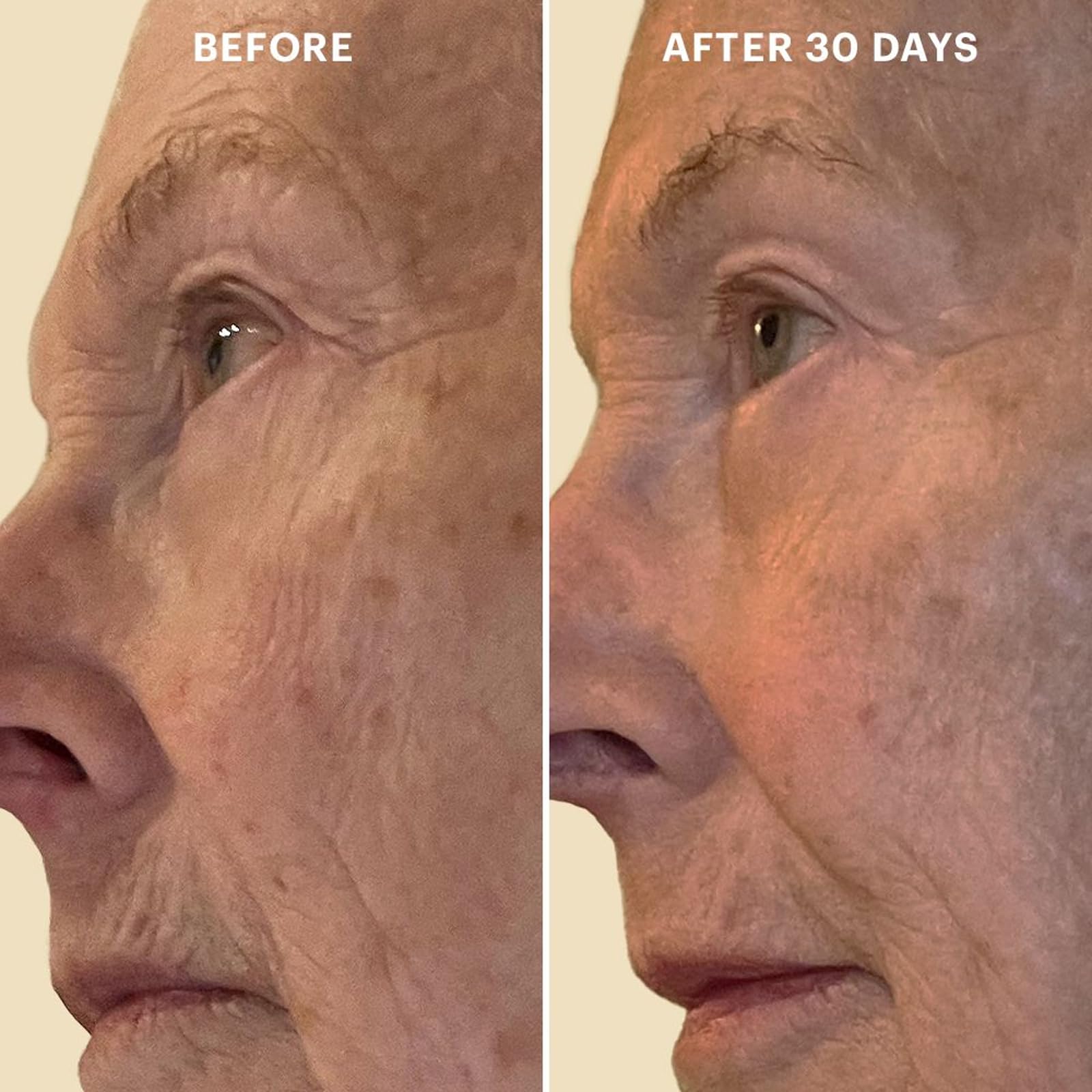 Glo Skin Beauty Bio-Renew EGF Eye Cream - Epidermal Growth Factor Cell Repairing Eye Cream, Combats Signs of Aging By Repairing, Hydrating & Firming Skin