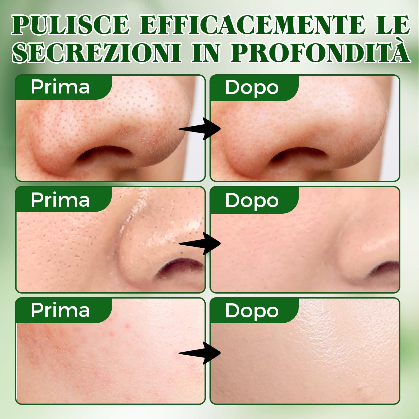Punti Neri Rimozione, 80pcs Carbone Cerotti Togli Punti Neri Naso per Una Pulizia Profonda, Liberando i Pori, Efficace e Delicata Nose Strips per Tutti i Tipi di Pelle