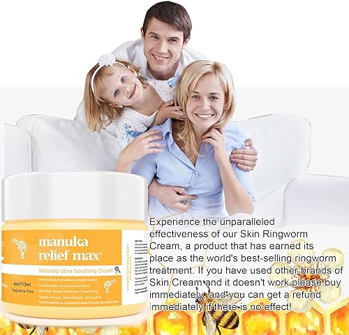 Miniatura 3 de Crema calmante para eccema de miel de Manuka, manos orgánicas, alivio del eccema corporal, ungüento natural para psoriasis, tiña de pies de mano,