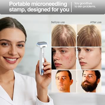 Derma Stamp 140 Pins, Microneedling + EMS + Vibration + Light Care, Microneedling Stamp with 2 Replaceable Heads (0.5mm) for Women & Men Facial Care/Beard/Hair Growth(bio 6, Silver White)