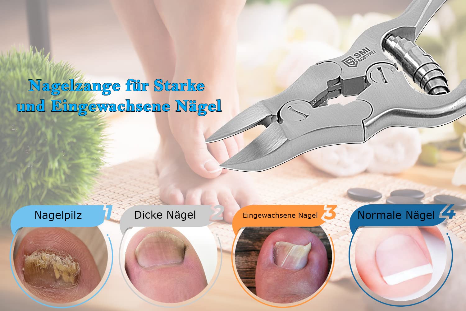 SMI 15,5 cm Tronchese Unghie Piedi per Unghie Spesse, Dure e Incarnite - Tagliaunghie Tronchesino Professionale Unghie Pesante Podologia Molla a Barile Sicurezza Bambino con Custodia