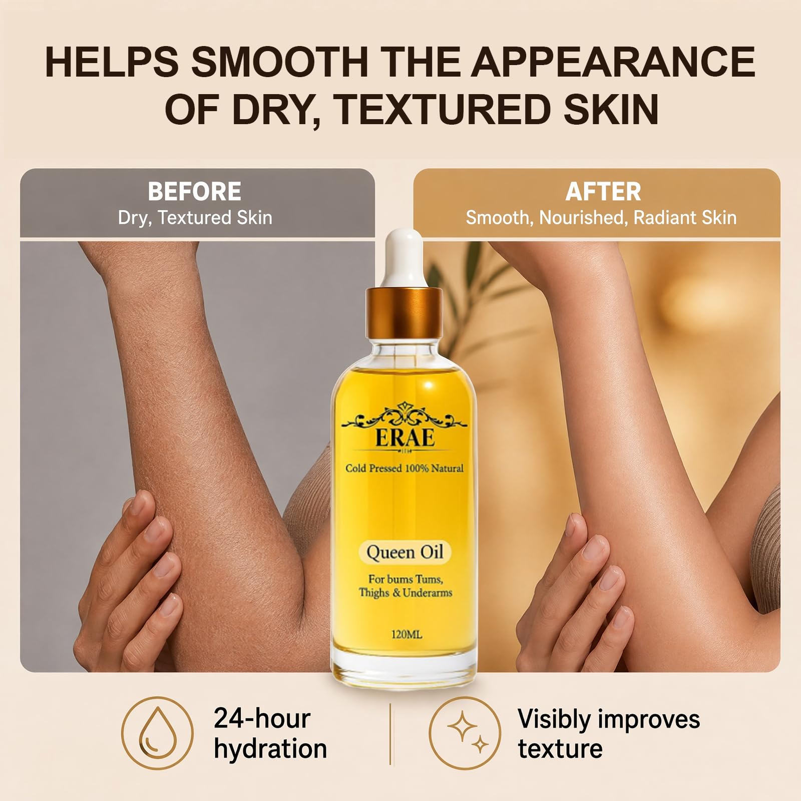 ERAE Queen Body Oil – Miscela botanica pressata a freddo per idratare e rassodare la pelle, olio idratante per il corpo leggero ad assorbimento rapido per braccia, gambe e stomaco