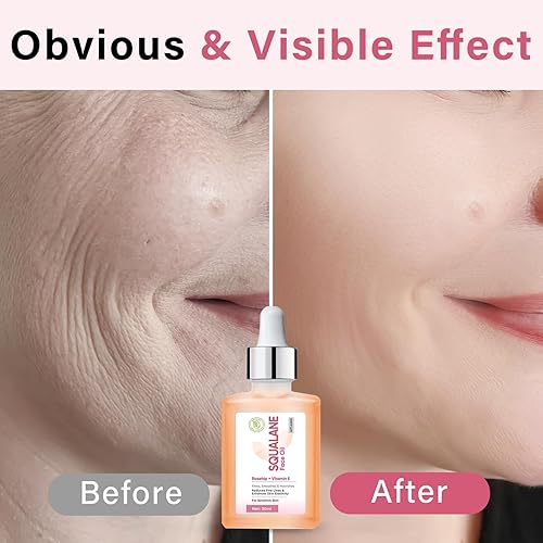 Miniatura 4 de Aceite de escaramujo de escualano para cara, hidratante e hidratante, aceite de vitamina E, aceite de escualano suave y firme para la cara, adecuado