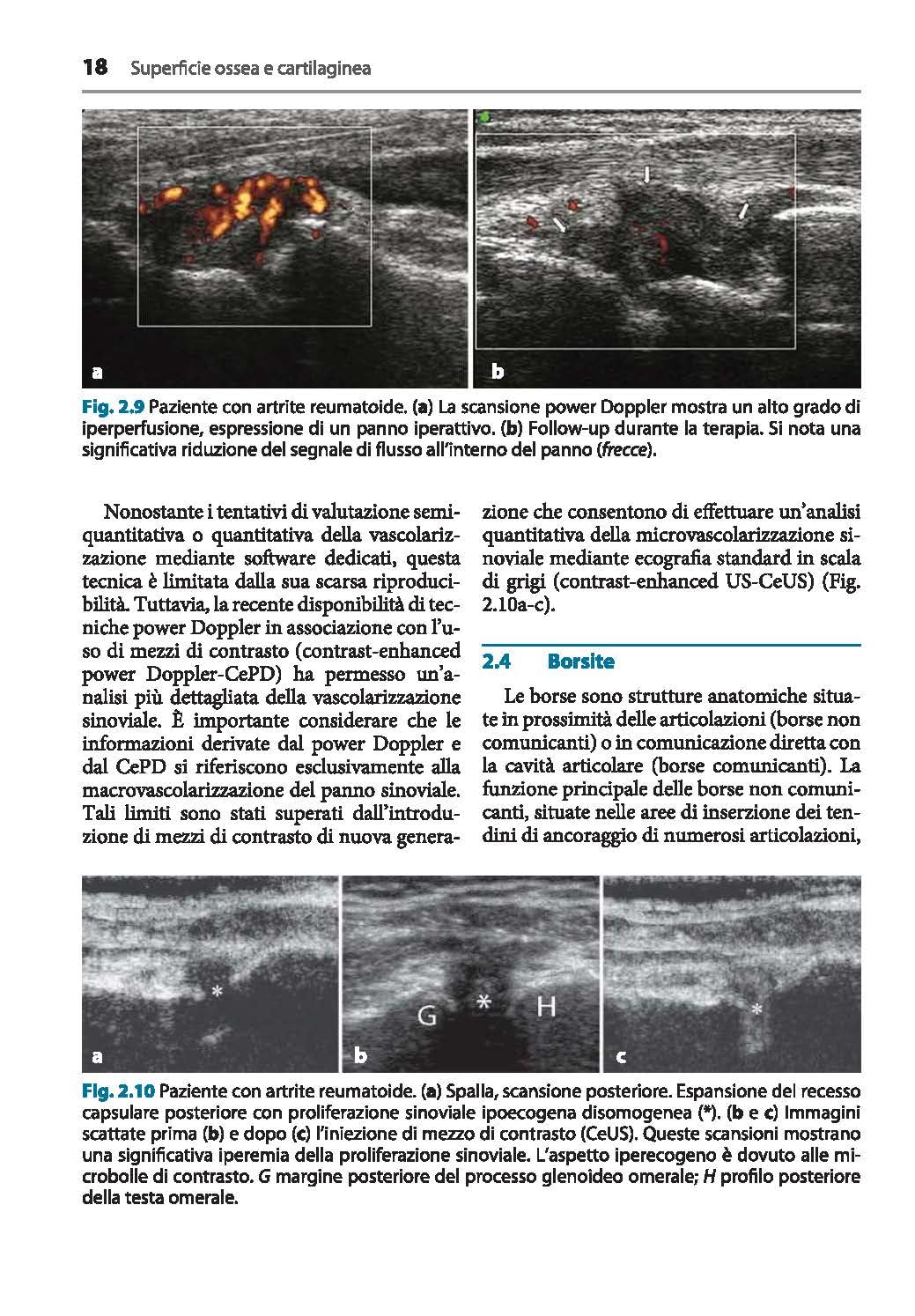 ECOGRAFIA MUSCOLOSCHELETRICA IN PATOLOGIA ORTOPEDICA E REUMATOLOGICA