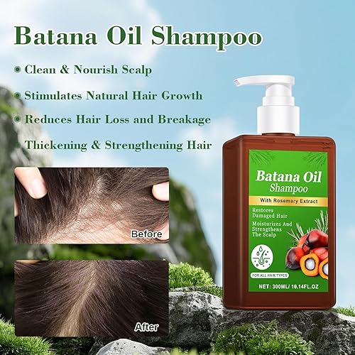 Miniatura 3 de -Promueve el crecimiento del cabello, champú de romero, nutre el cuero cabelludo, reduce la rotura y agrega brillo, reduce la pérdida de cabello