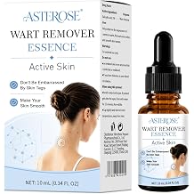Mole & Wart Remover for Face & Body, Fast-Acting Freeze-Off